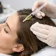 Кому показана мезотерапия волосистой части головы